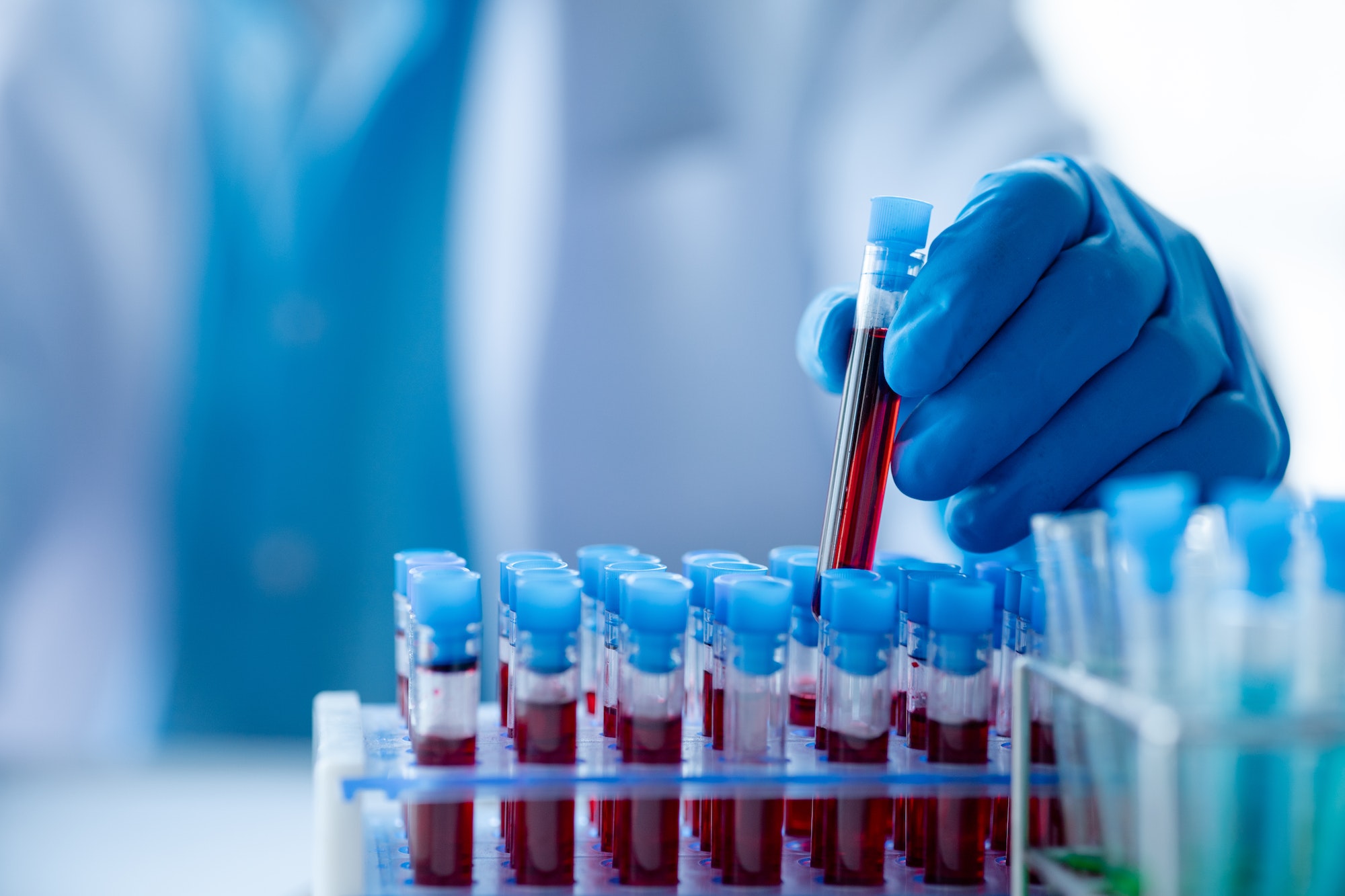 Lab assistant, a medical scientist, a chemistry researcher holds a glass tube through the blood samp